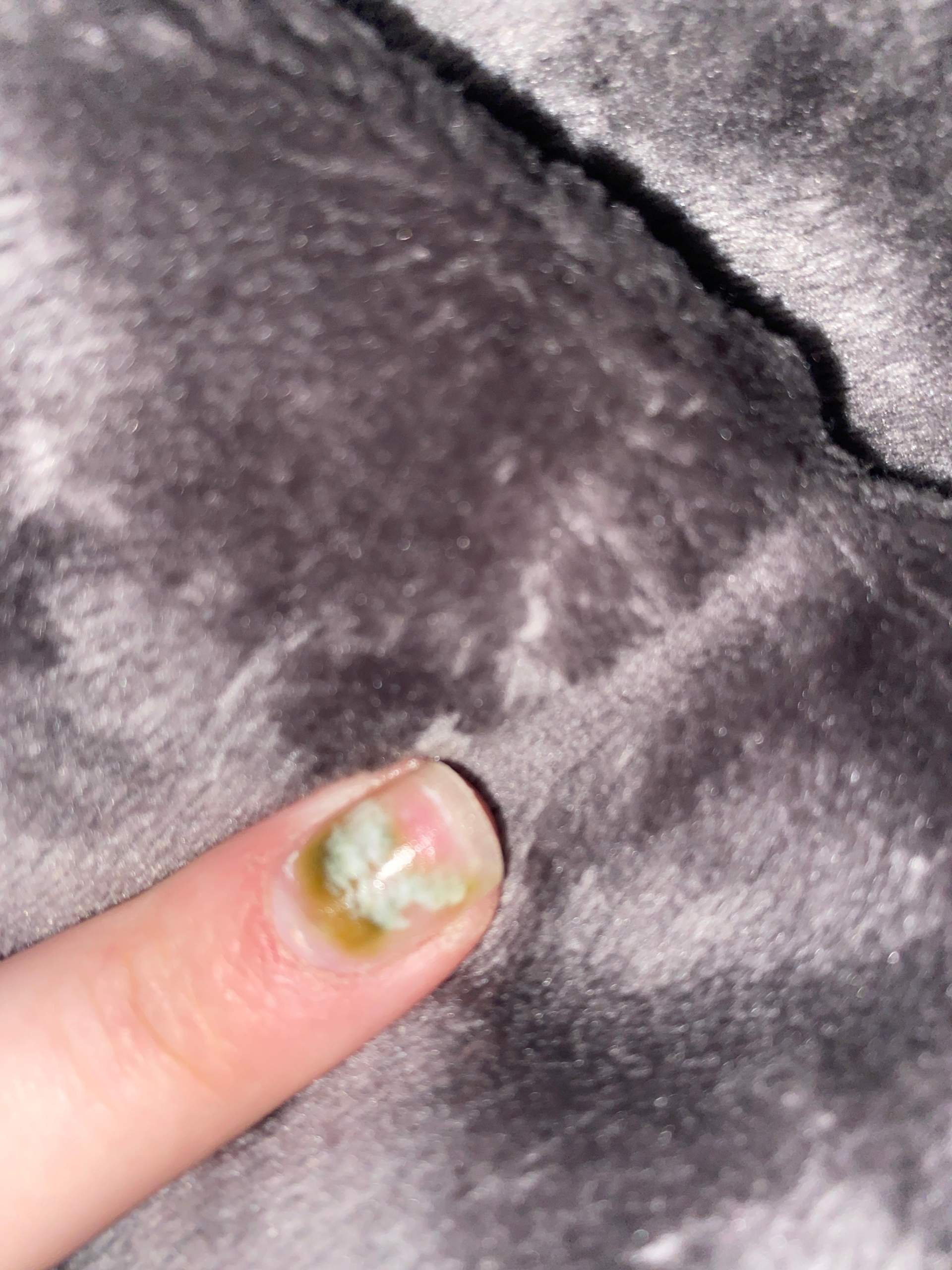 Warum ist mein Nagel grün? (Nägel, Gelnägel)