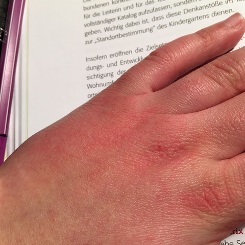 Das ist die hand - (Haut, Hand, rot)