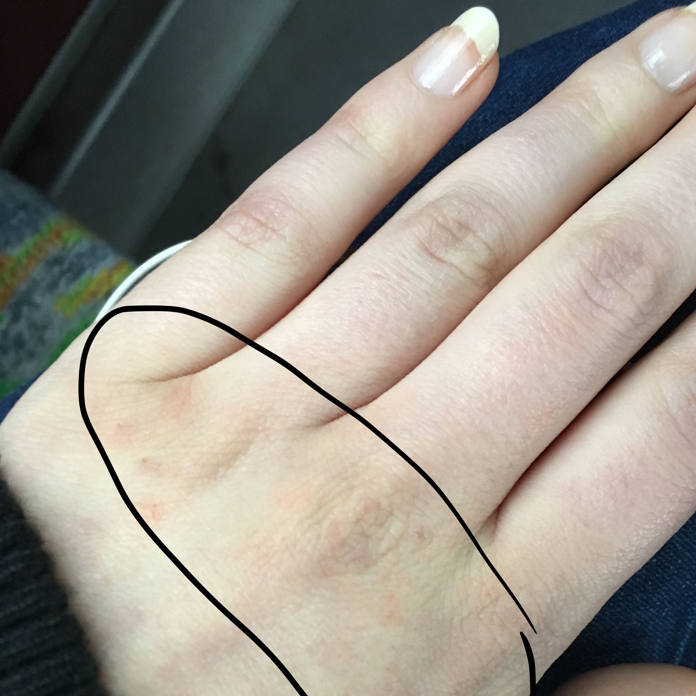 Linke Hand Juckt Was Bedeutet Das Linke Hand Juckt Was Bedeutet Das