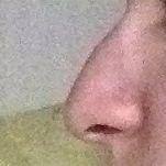 - (Nase, seltsam)