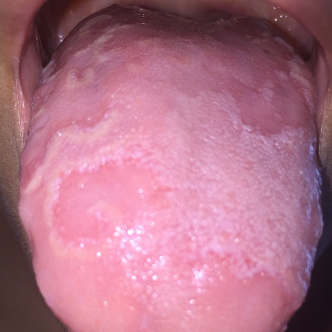 Meine Zunge  - (Gesundheit, Zunge)