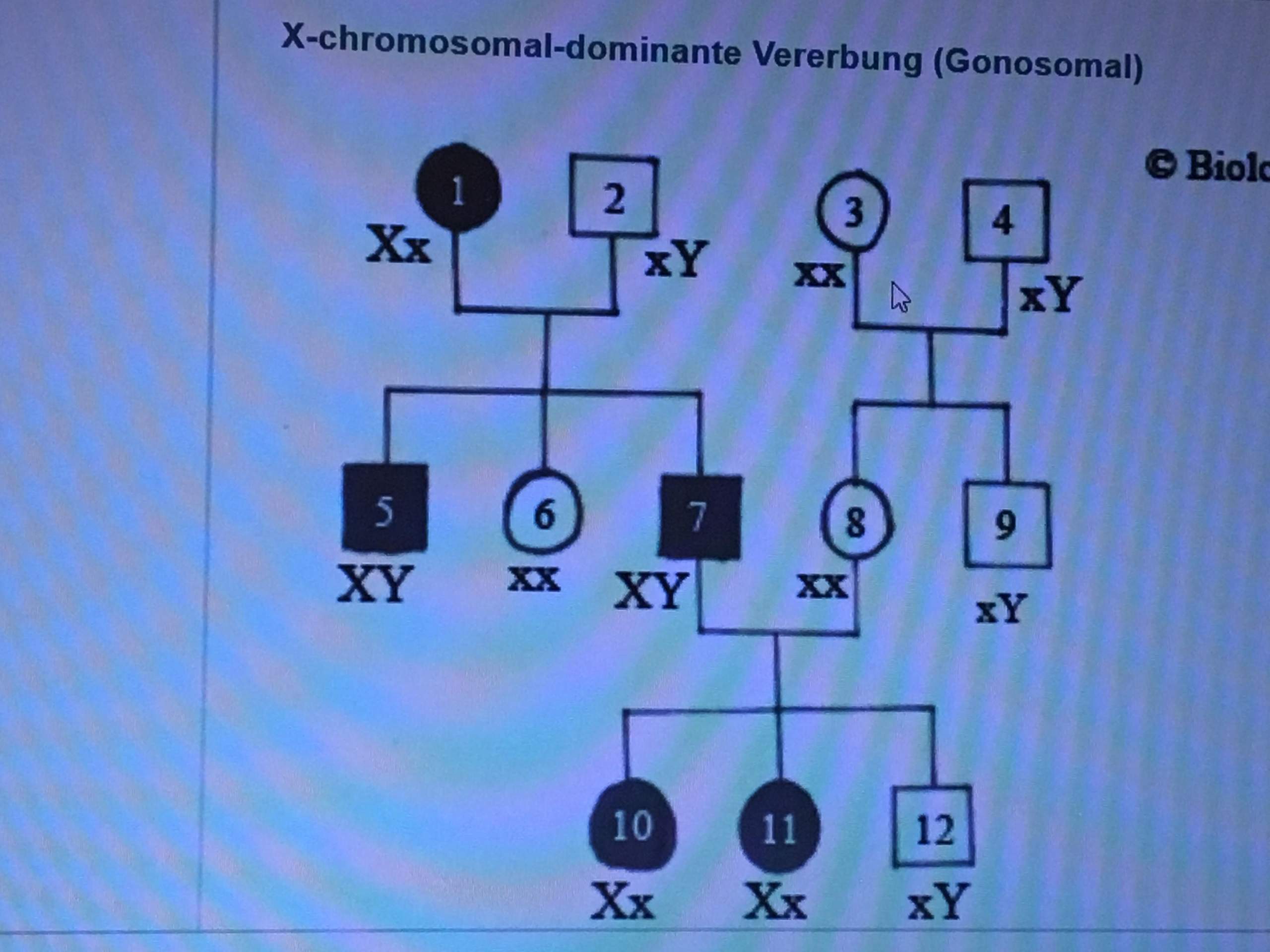 autosomal rezessive Vererbung