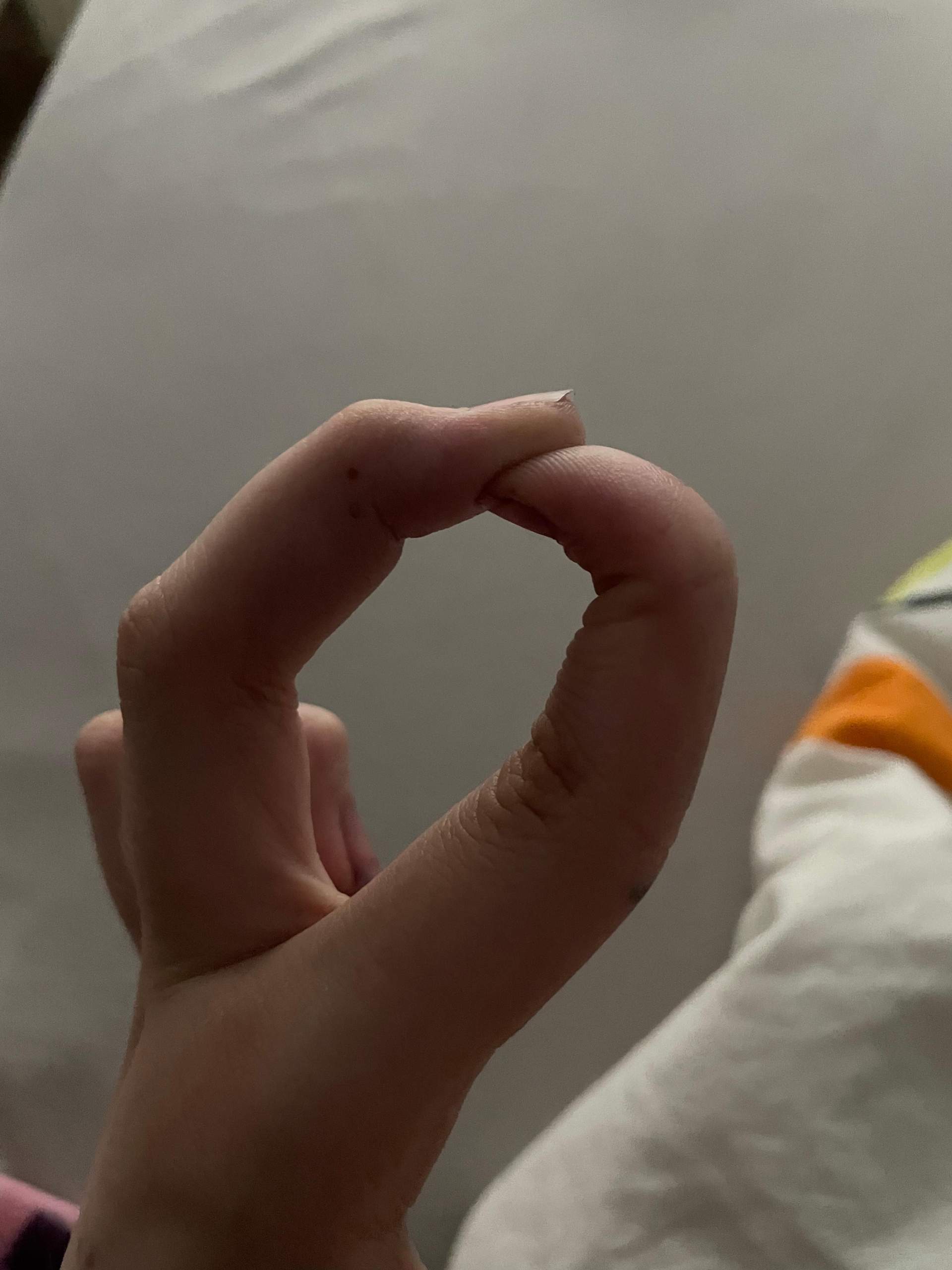 Warum können meine Finger sich so bewegen? (Gesundheit und Medizin
