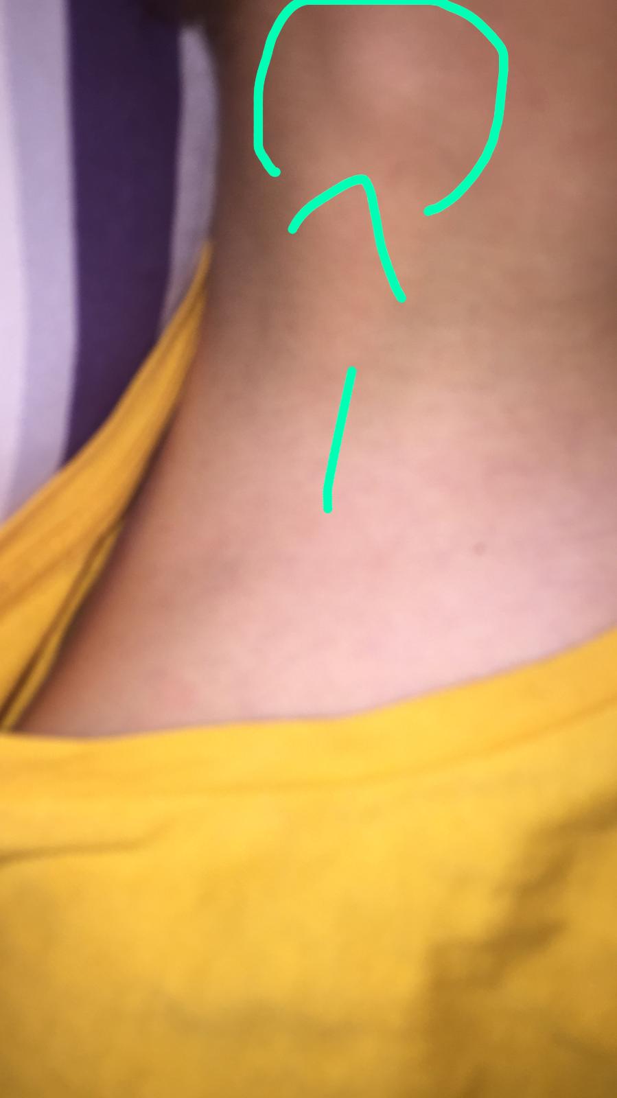 warum sind meine lympfknoten so dick gesundheit und medizin korper