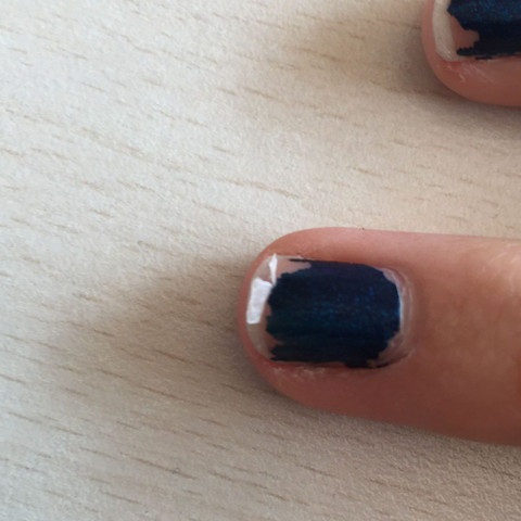 Bissl verschwommen das bild - (Magersucht, Nagellack, Fingernägel)