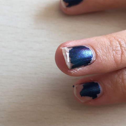Hier sieht man es gut, da kann man es wie wegschälen - (Magersucht, Nagellack, Fingernägel)