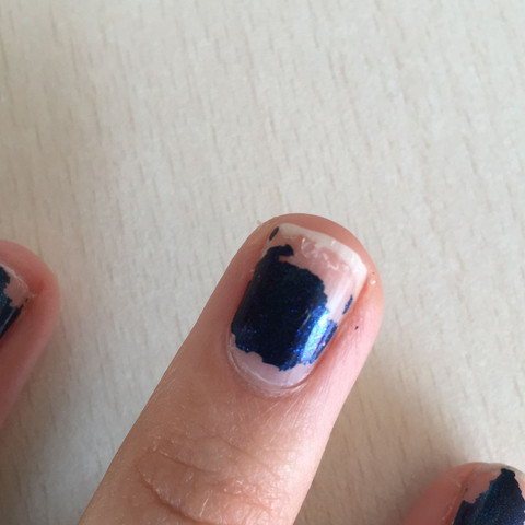 Und danach sieht ws meistens so aus - (Magersucht, Nagellack, Fingernägel)