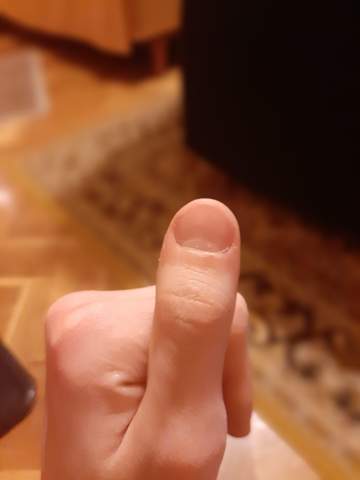 Warum sind meine Nägel so breite?