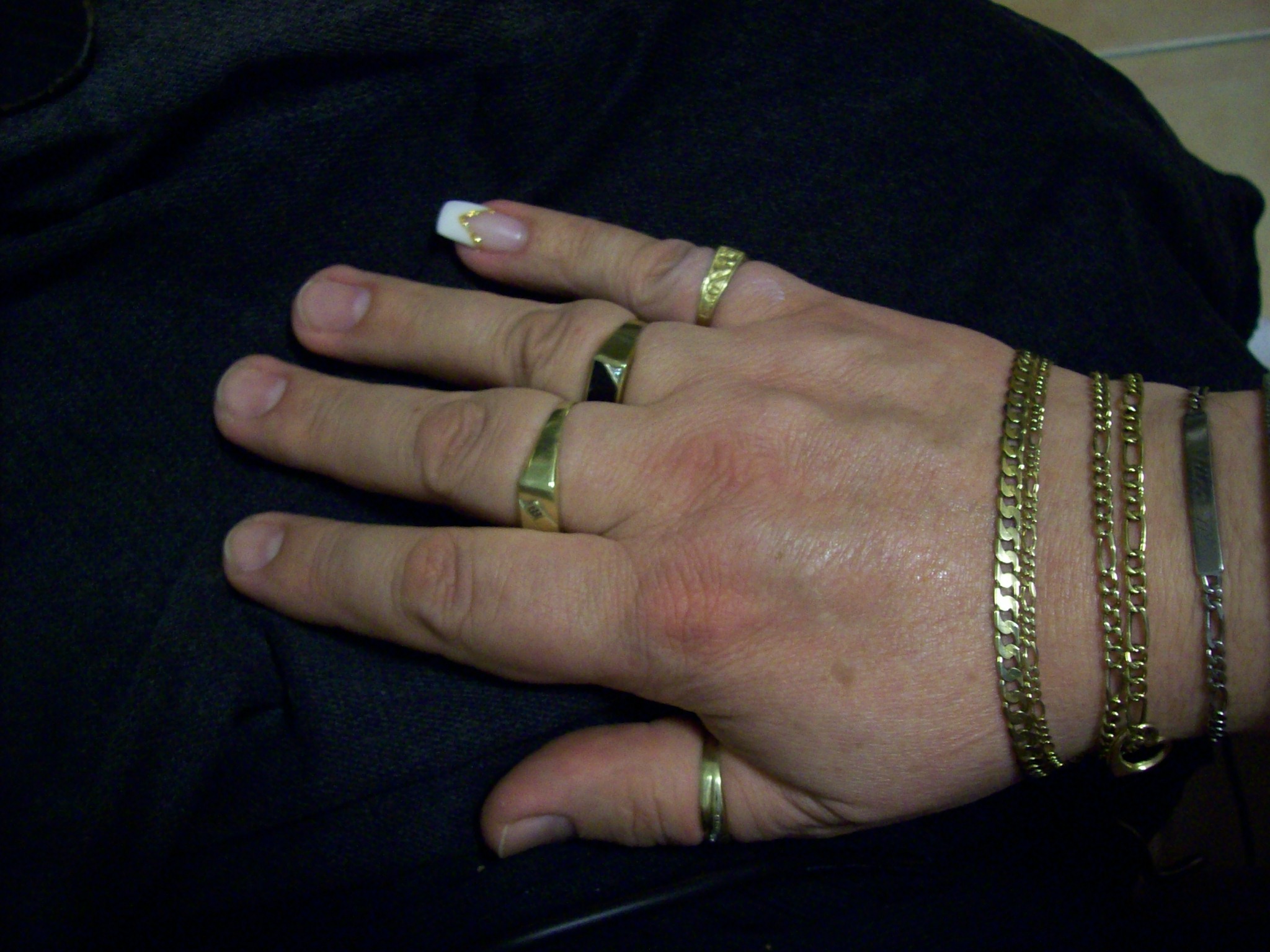 Fingern Fingern
