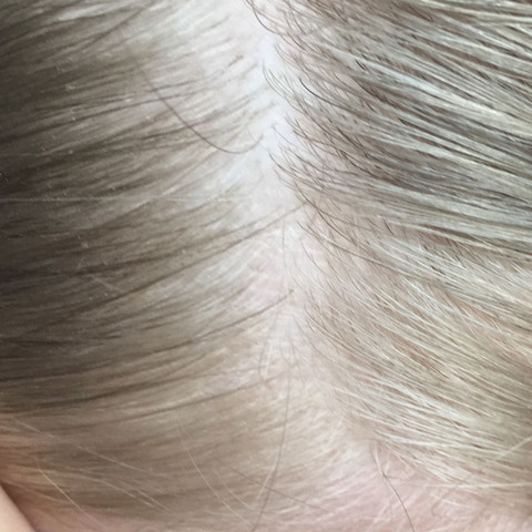 Warum Wachsen Einzelne Haare Viel Dunkler Nach Friseur Ansatz