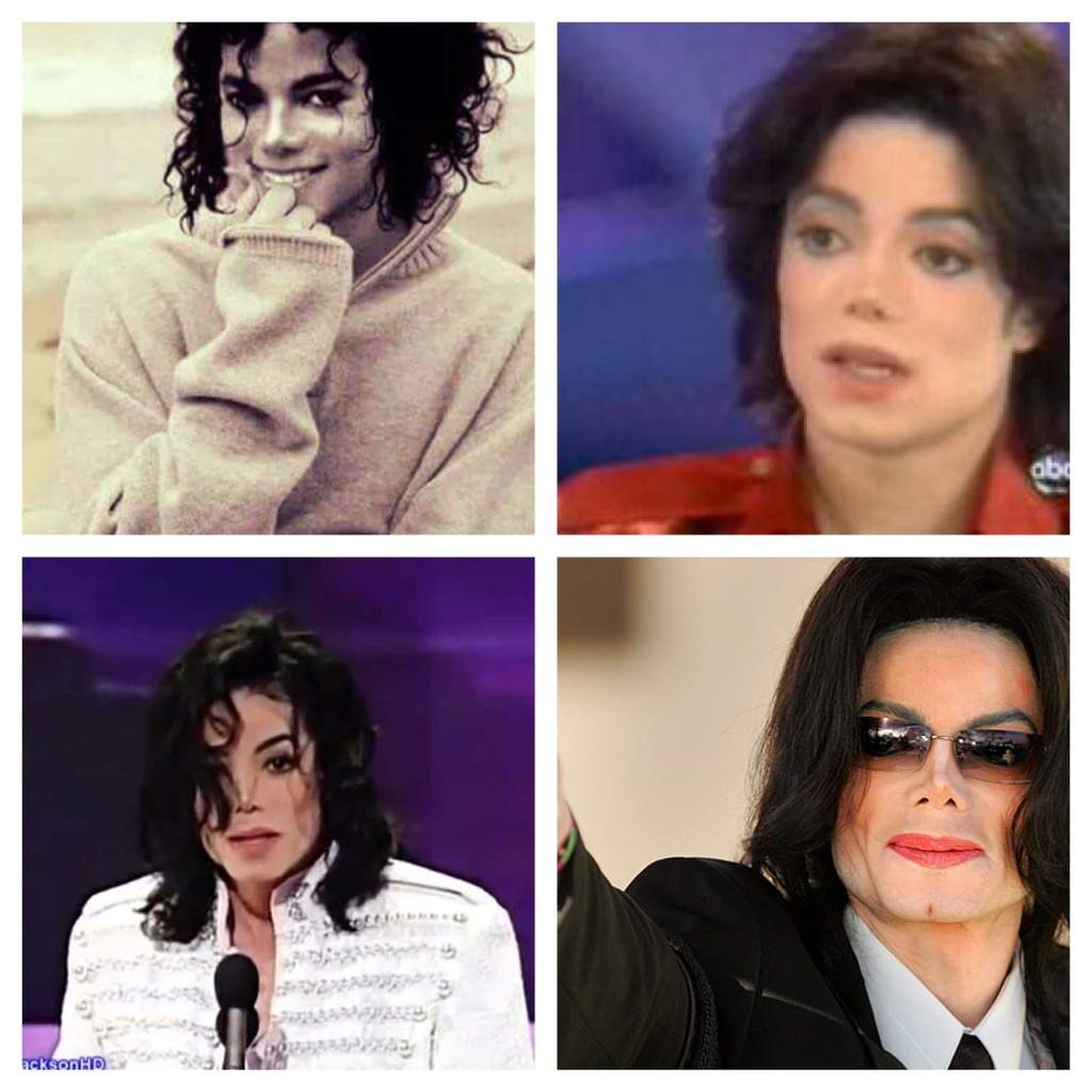Warum Hat Michael Jackson Sich Weiß Gemacht