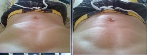Vor und nach dem Essen - (Bauch, Verdauung)
