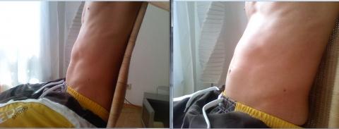 Warum wird ein sehr flacher Bauch nach dem Essen unförmig/asymetrisch? (Verdauung)