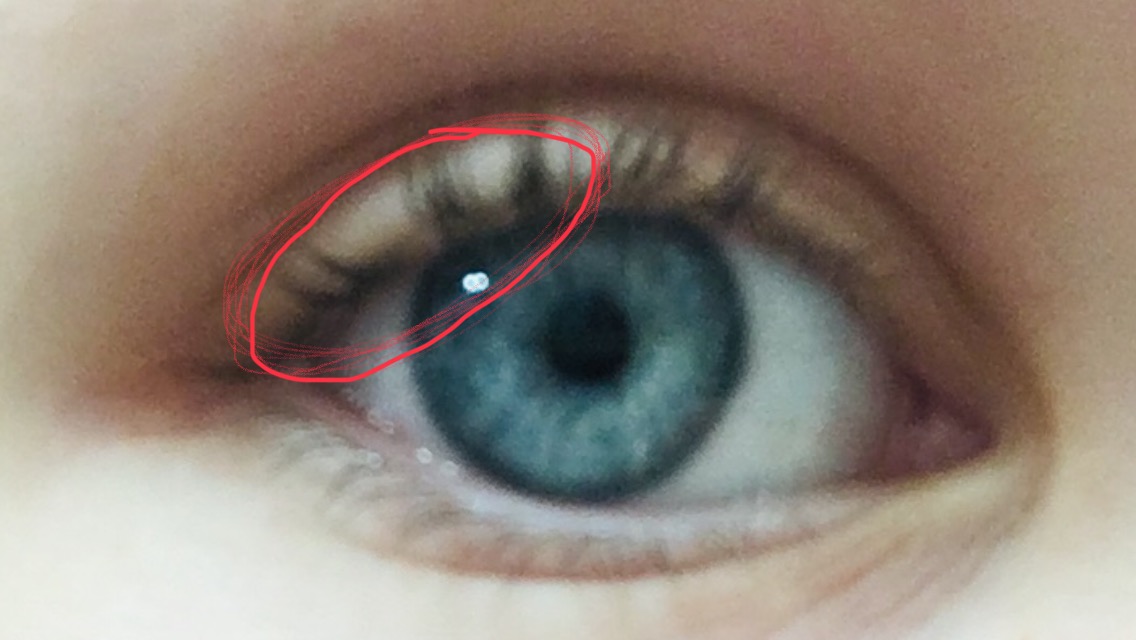Warum Zuckt Mein Auge So Gesundheit Augen Zucken Warum Zuckt Mein Auge So Gesundheit Augen Zucken