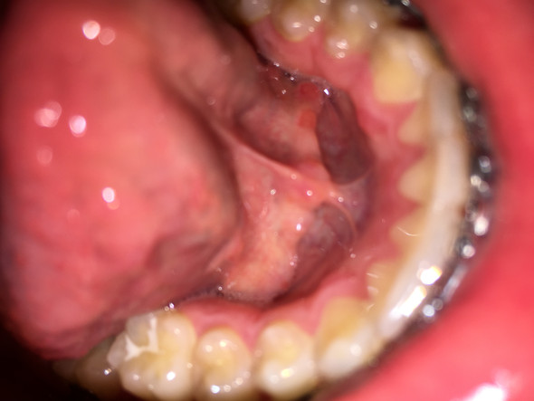 Download Pickel Im Ohrloch Gif