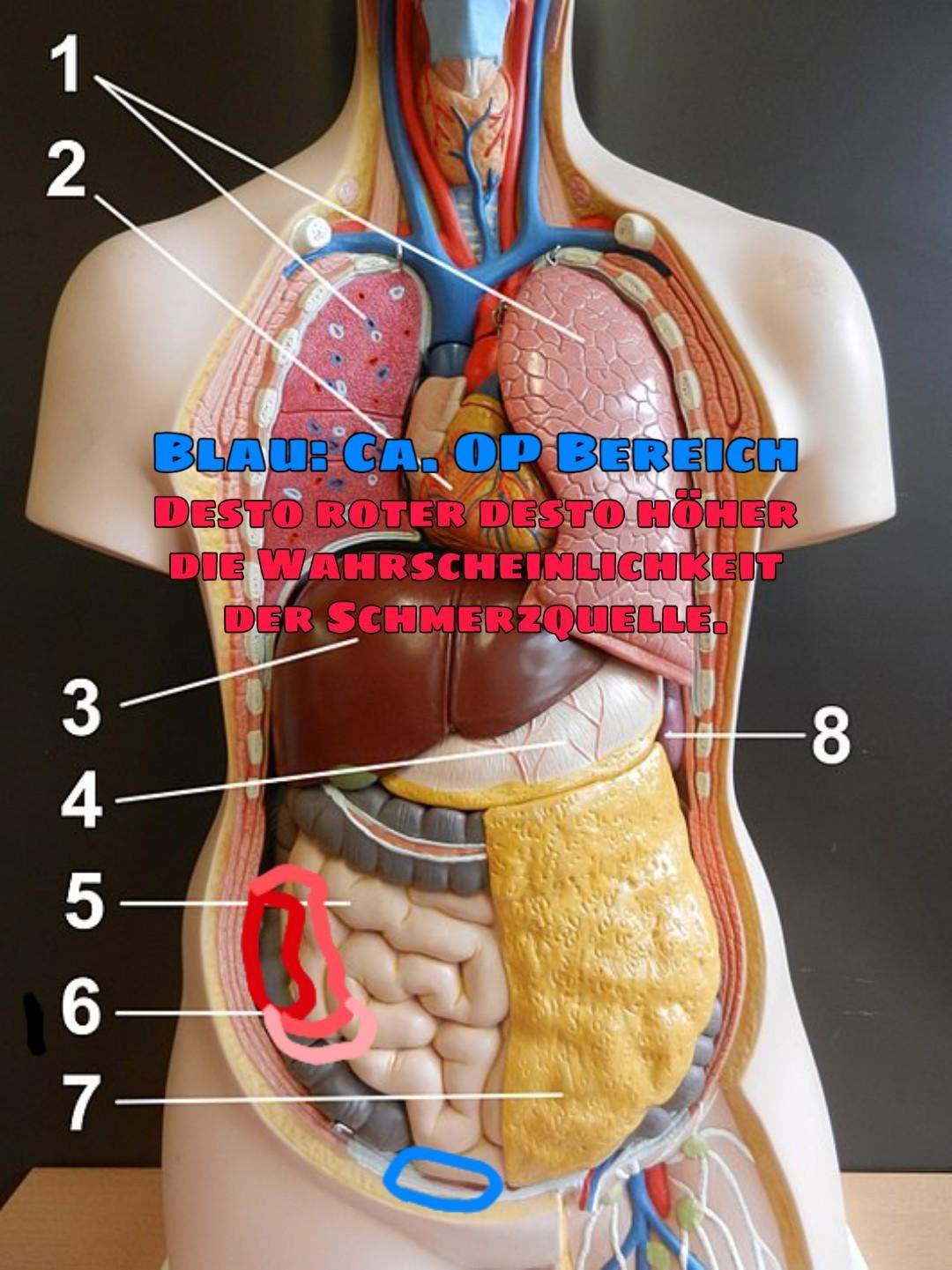 Was anderes als Blinddarm? (Gesundheit und Medizin, Gesundheit, Menschen) Was anderes als Blinddarm? (Gesundheit und Medizin, Gesundheit, Menschen)