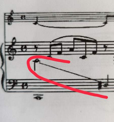 Was bedeutet diese Linie, die zwei Noten verbindet?
