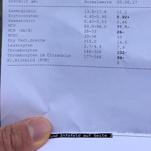 Was Bedeutet Thrombozyten Zu Niedrig Gesundheit Und Medizin Was Bedeutet Thrombozyten Zu Niedrig Gesundheit Und Medizin
