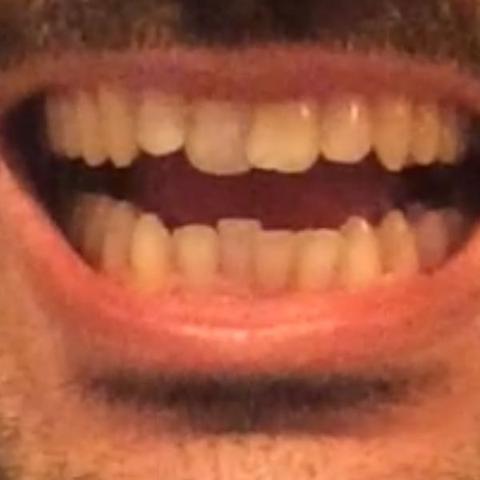 Zahn1 - (Zähne, Kosten, Zahnarzt)