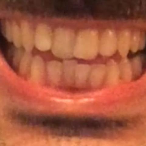 Zahn3 - (Zähne, Kosten, Zahnarzt)