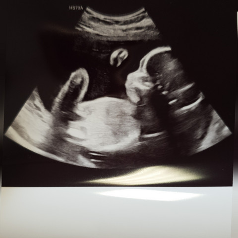 Was Denkt Ihr Welches Geschlecht Schwanger Baby Was Denkt Ihr Welches Geschlecht Schwanger Baby