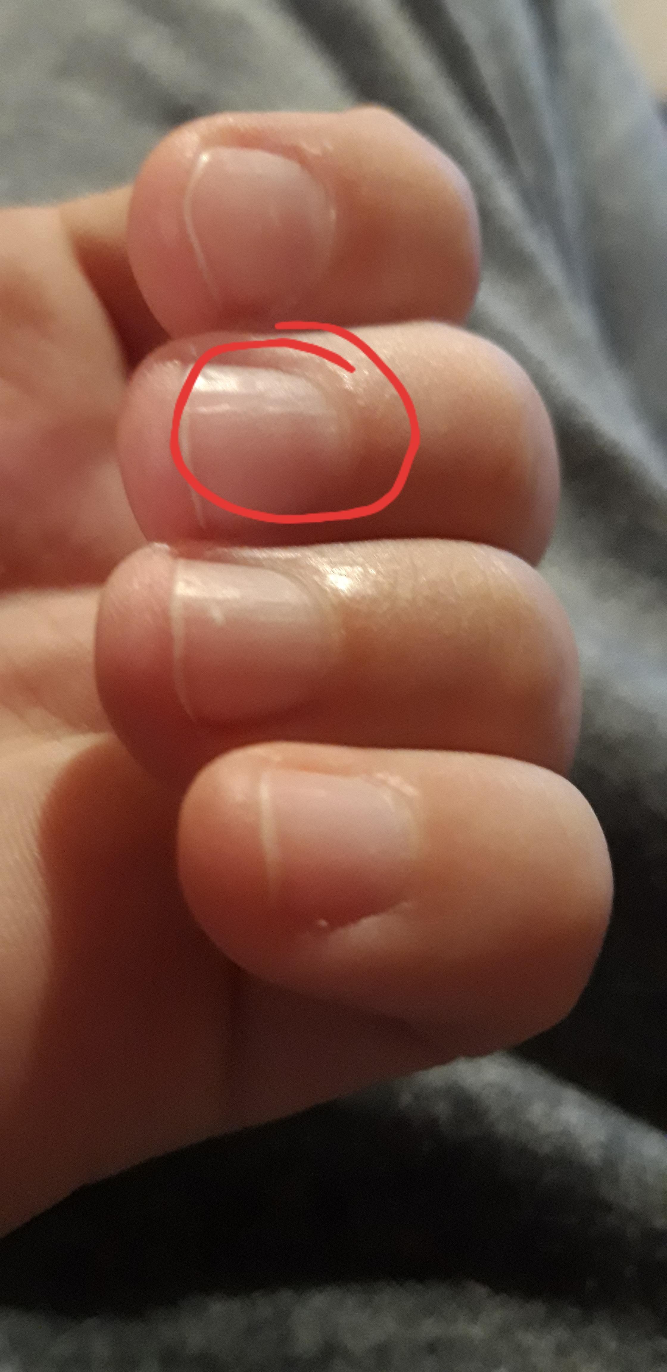 Was fehlt meinen Fingernägeln? (Gesundheit und Medizin, Beauty, Nägel) Was fehlt meinen Fingernägeln? (Gesundheit und Medizin, Beauty, Nägel)