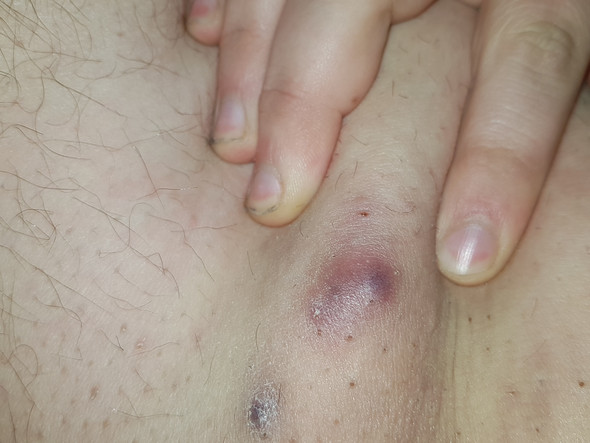Pickel Zwischen Den Beinen Quotes