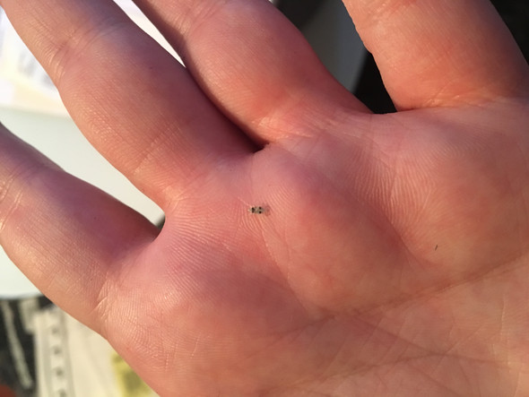Ranzoomen macht es besser sichtbar - (Insekten, Stich, Flöhe)