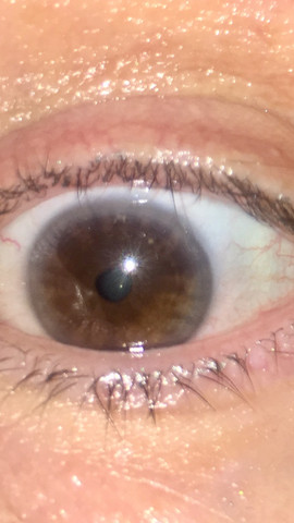 Was Fur Eine Augenfarbe Braun Blau Gibt Es Doch Nicht Augen