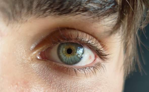 - (Augen, Augenfarbe)