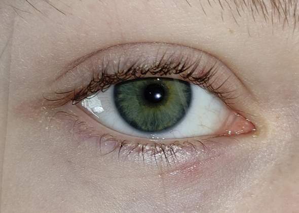 Was für eine Augenfarbe ist das?