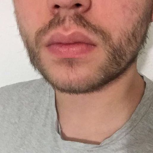 Was für einen Bart kann ich mir wachsen lassen? (Bartwuchs) - 1 Original Was für einen Bart kann ich mir wachsen lassen? (Bartwuchs) - 1 Original