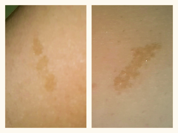 Was für Male sind das auf dem Foto? (Gesundheit)