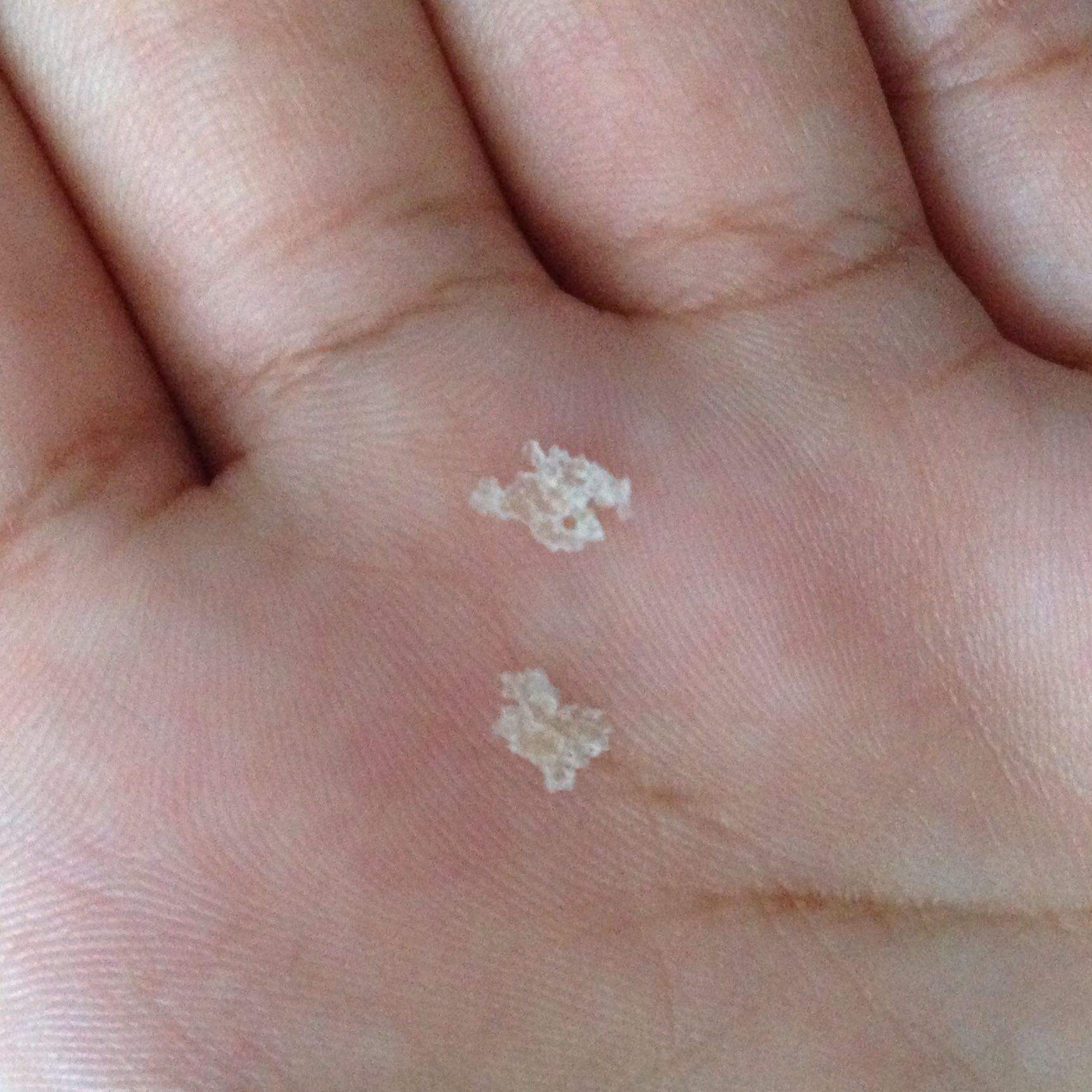 Was Gegen Grosse Schuppen Tun Gross Sprechstunde Headshoulders 16 X2 Was Gegen Grosse Schuppen Tun Gross Sprechstunde Headshoulders 16 X2