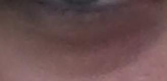 augenringe-.- - (Augen, Augenringe, Mittel)