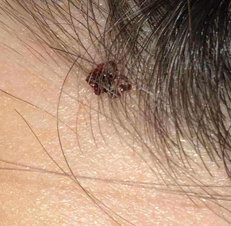 Was genau ist das auf meiner Kopfhaut? (Gesundheit und Medizin, Gesundheit, Haare)