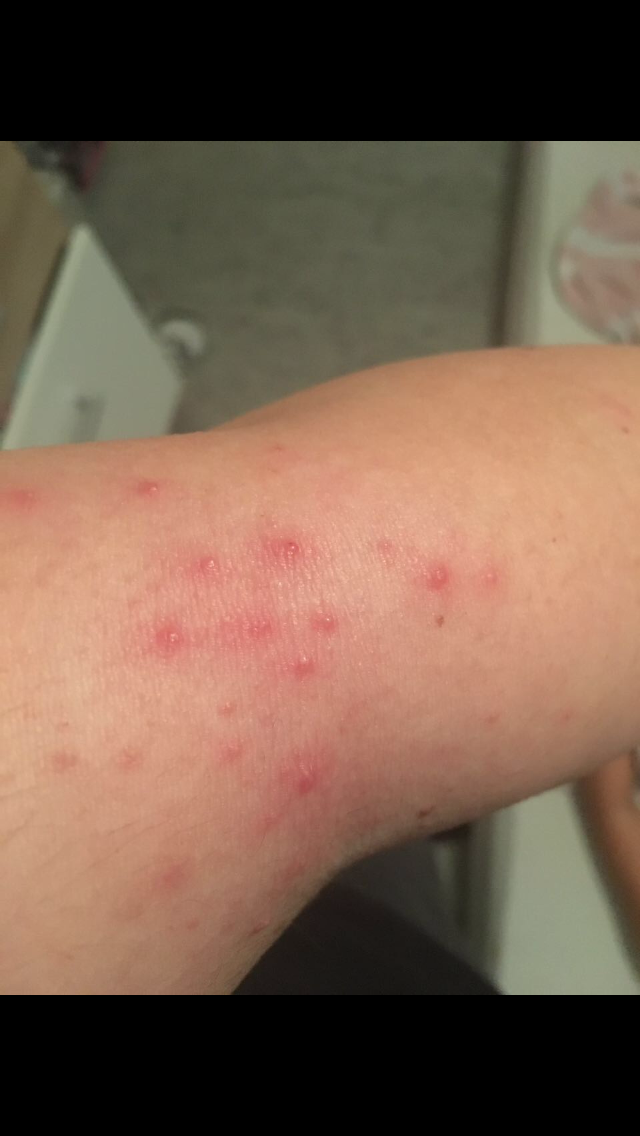 Was genau kann das sein? Ausschlag, Allergie? Sollte ich mir