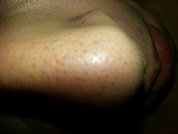 die schwarzen punkte: - (Kosmetik, Nase, Hautpflege)