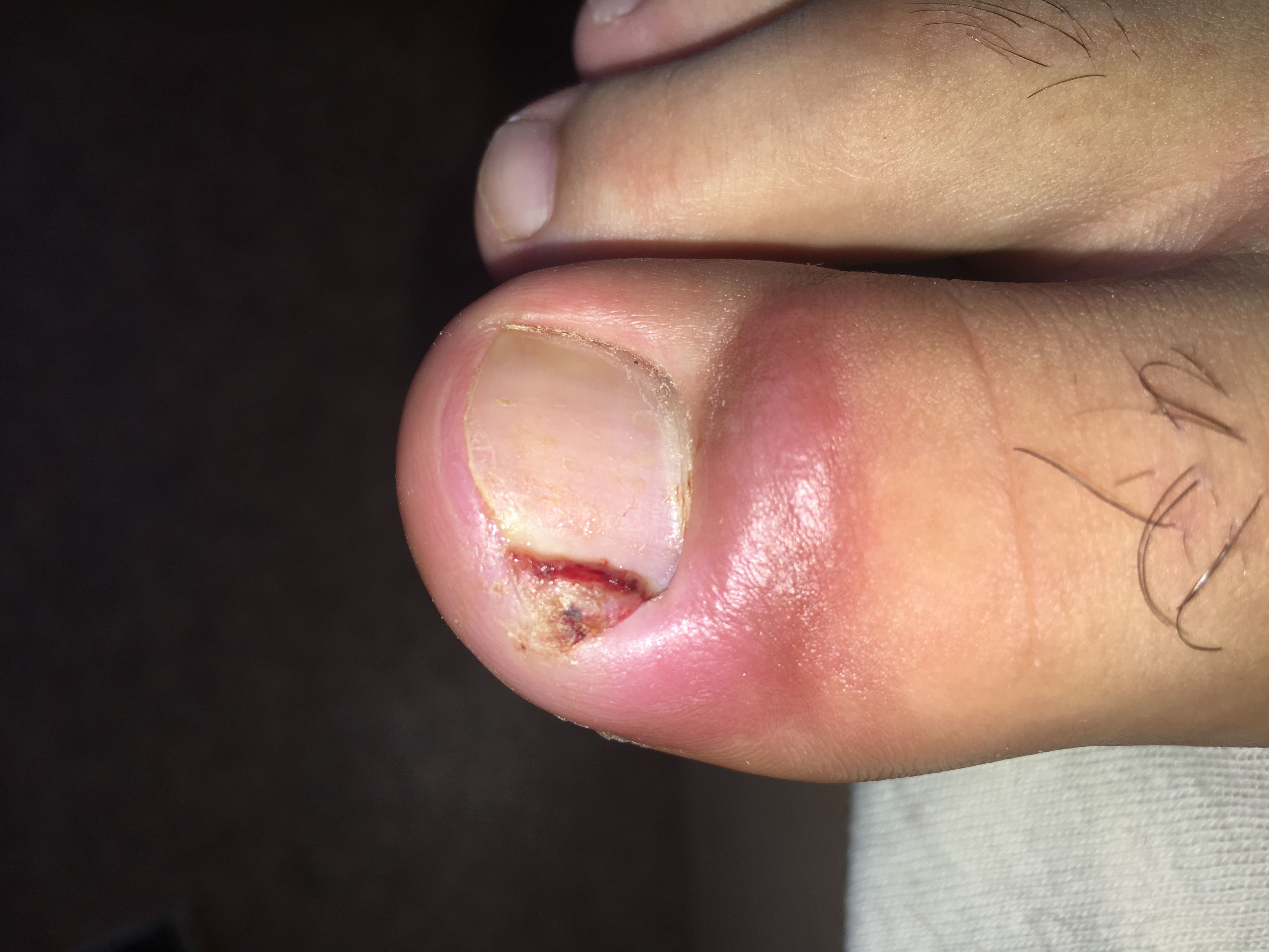 Was habe ich am Zeh? (Gesundheit und Medizin, Gesundheit, Medizin) Was habe ich am Zeh? (Gesundheit und Medizin, Gesundheit, Medizin)