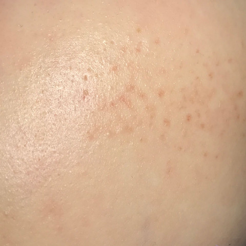 Das ist meine Wange. - (Medizin, Arzt, Haut)