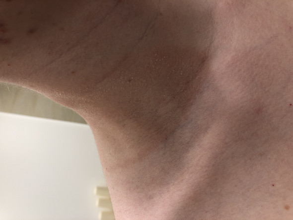 - (Gesundheit und Medizin, Arzt, Krankheit)