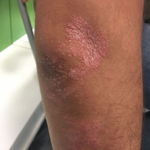Mein arm - (Gesundheit, Gesundheit und Medizin, Medizin)