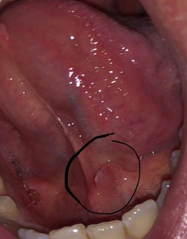 Was Habe Ich Unter Der Zunge Gesundheit Und Medizin Was Habe Ich Unter Der Zunge Gesundheit Und Medizin