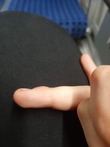 Hubbel am finger