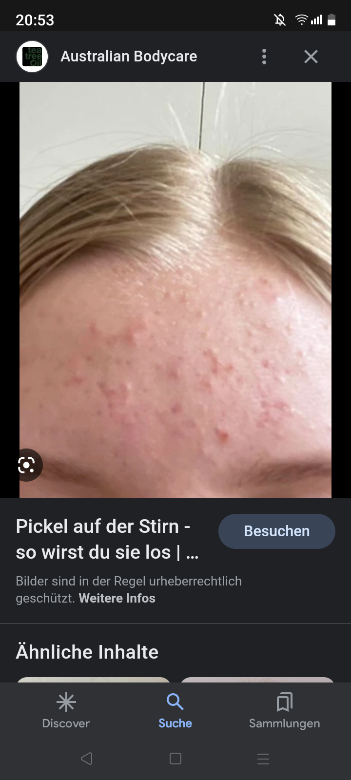 Was hilft gegen solche pickeln an der Stirn? (Mädchen, Frauen, Haut)