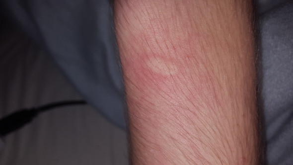 - (Gesundheit, Medizin)