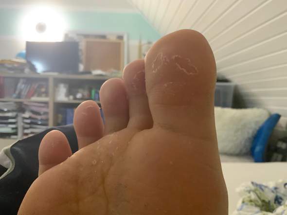 Was ist an meinem Fuß?