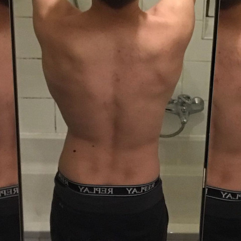 Mein Rücken spiegelverkehrt - (Arzt, Training, Muskeln)
