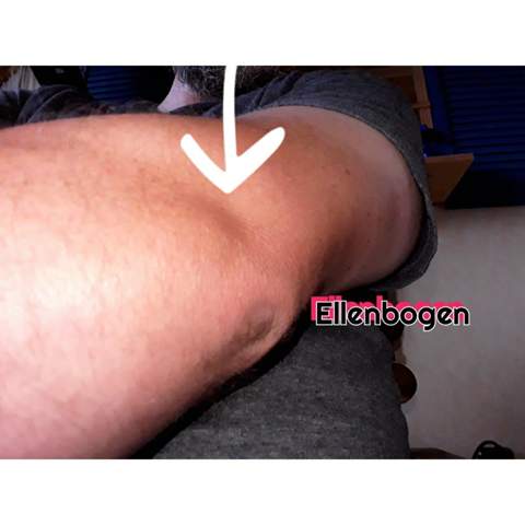 Was Ist Das Siehe Bild Gesundheit Und Medizin Gesundheit Medizin Was Ist Das Siehe Bild Gesundheit Und Medizin Gesundheit Medizin