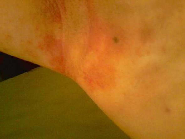 Achselhoehle Die Meistgelesenen Fragen Achselhoehle Die Meistgelesenen Fragen